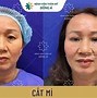 Cách Để Mắt Không Bị Dại